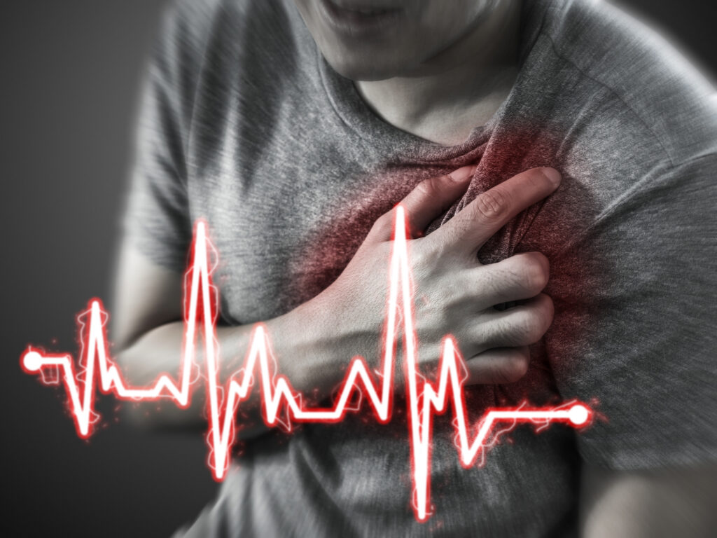 Atrial Fibrillation Awareness